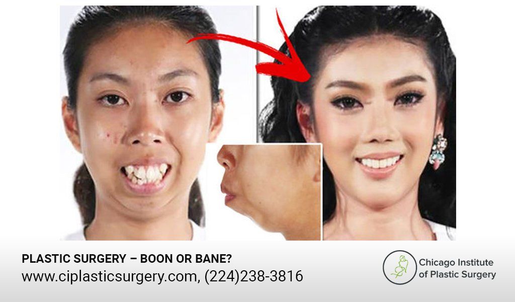 Plastic Surgery Boon or Bane?