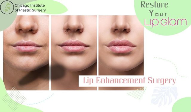 Redefine And Restore Your Lip Glam With Lip Enhancement Surgery In Chicago