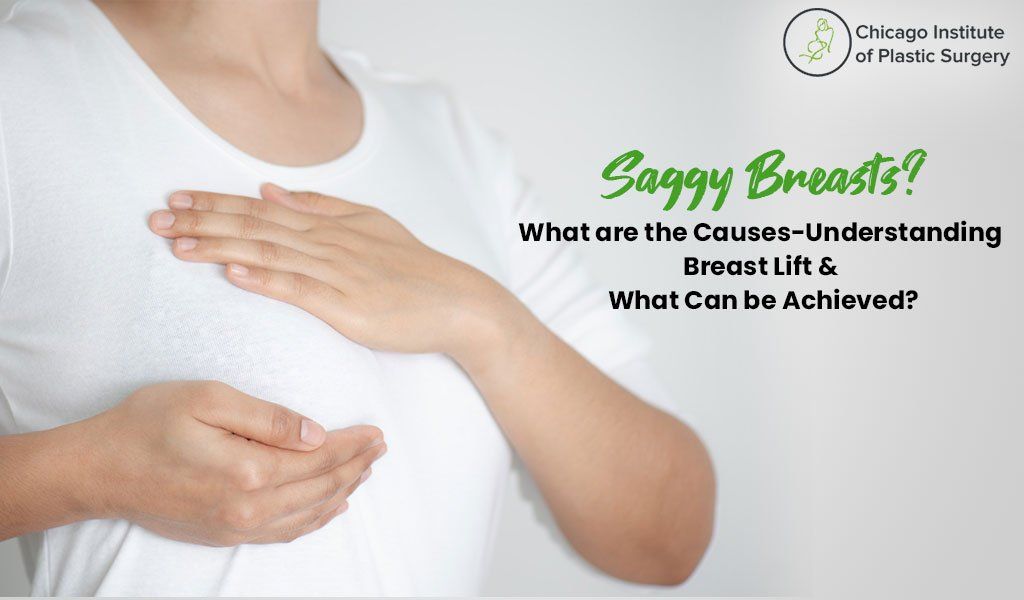 Why do breasts sag, how to treat sagging breast - Concern