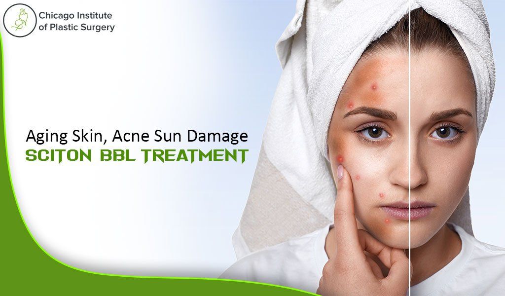 Stop the clock on the appearance of aging skin, acne, and sun damage with sciton BBL treatment