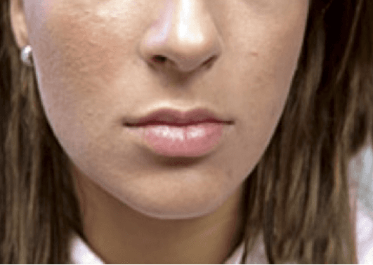 A close up of a woman 's face with her mouth open