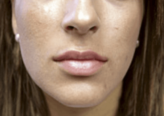 A close up of a woman 's lips and nose