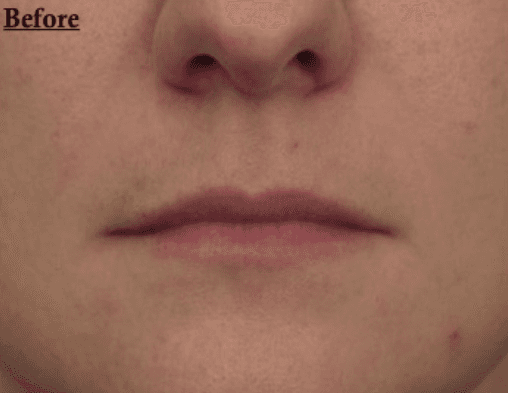 A close up of a person 's face with the words `` before '' written on it.