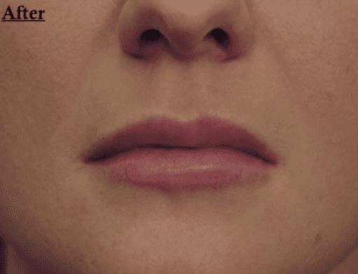 A close up of a woman 's lips with the words after written on the bottom.