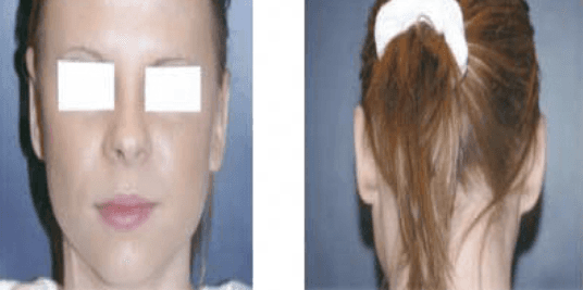 A woman with a ponytail and a white headband on her head