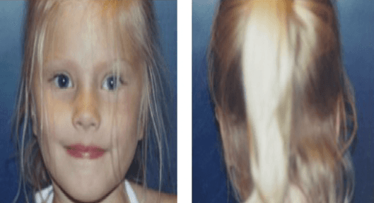 A close up of a little girl 's face and a close up of her hair