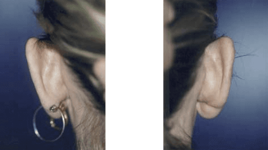 A close up of a woman 's ears with hoop earrings