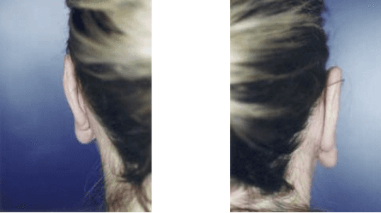 A close up of a person 's ear with a blue background