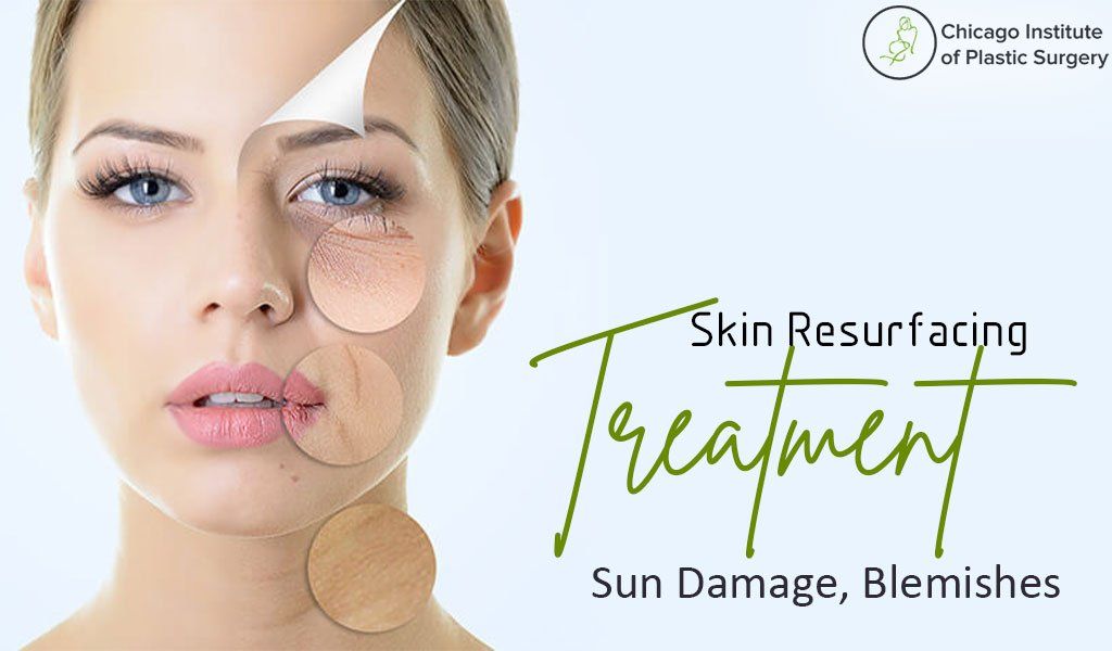 Skin Resurfacing Treatments - Minimize blemishes, treat sun damage & restore a more youthful