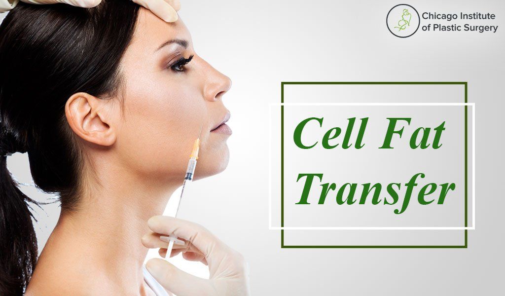 What is Cell Fat Transfer and How You Can Benefit from this Treatment?