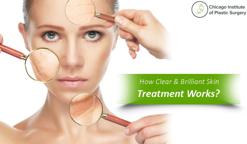 What is Clear & Brilliant Skin Treatment| How it works| What are the benefits of Clear & Brilliant Skin Treatment