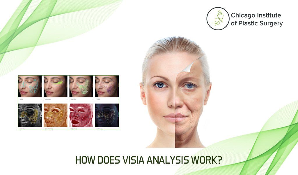 What is the VISIA Skin Analysis, How Does Visia Analysis Work