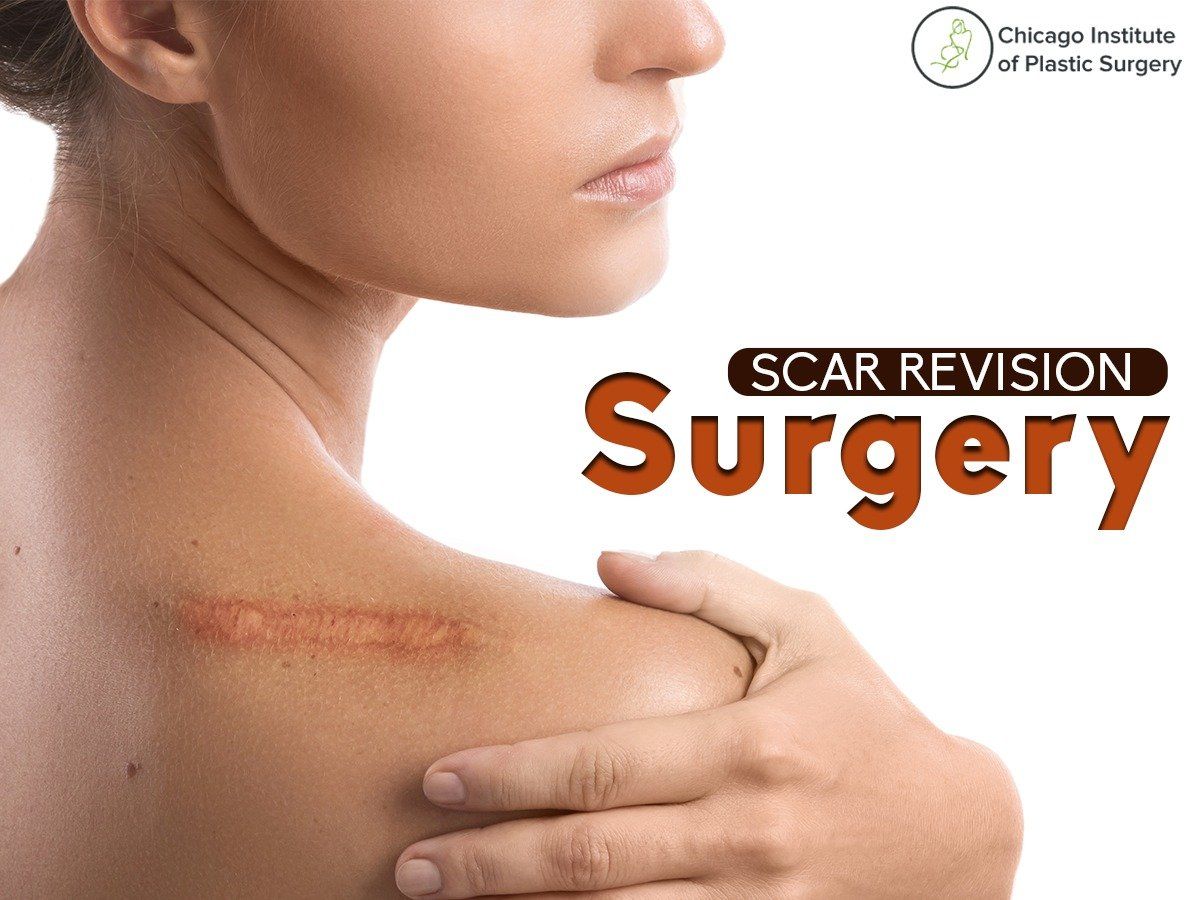 scar-revision-surgery