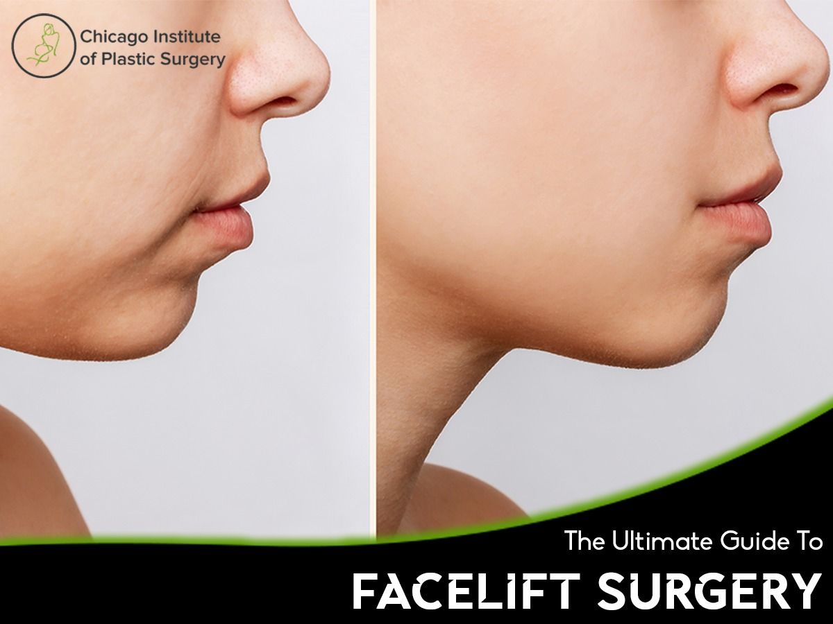 Facelift Surgery Guide: Everything You Need to Know
