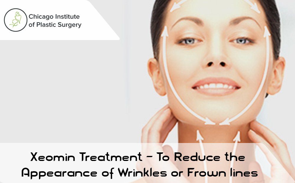 Xeomin Treatment – To Reduce the Appearance of Wrinkles or Frown lines