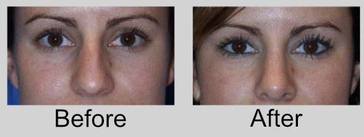 A before and after picture of a woman 's face