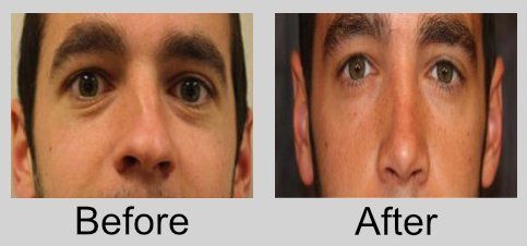 A before and after picture of a man 's face