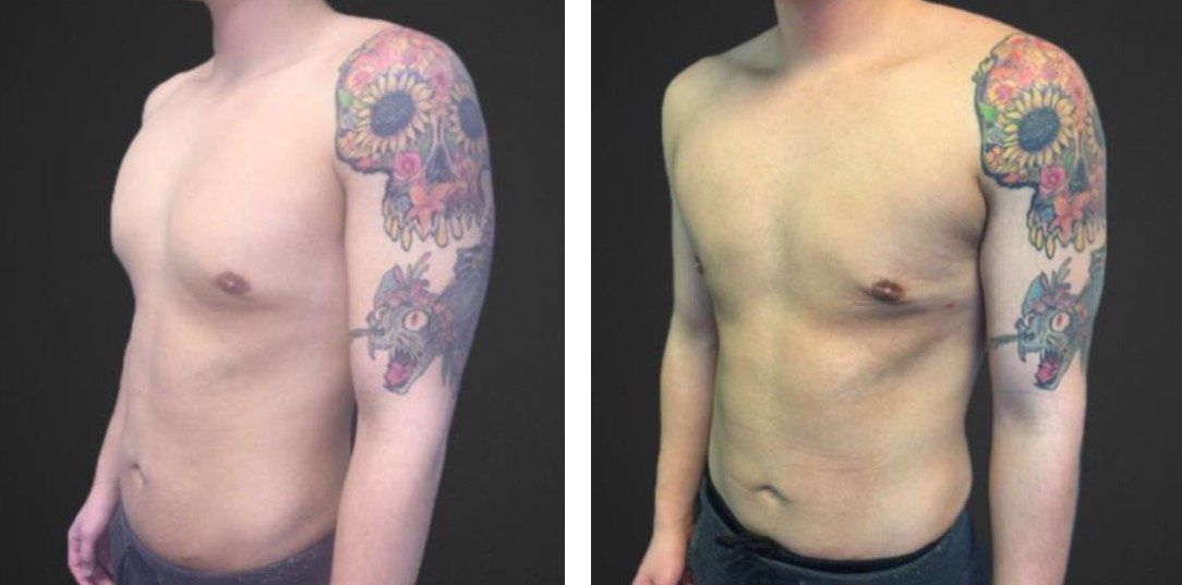 A man without a shirt has a tattoo on his arm.