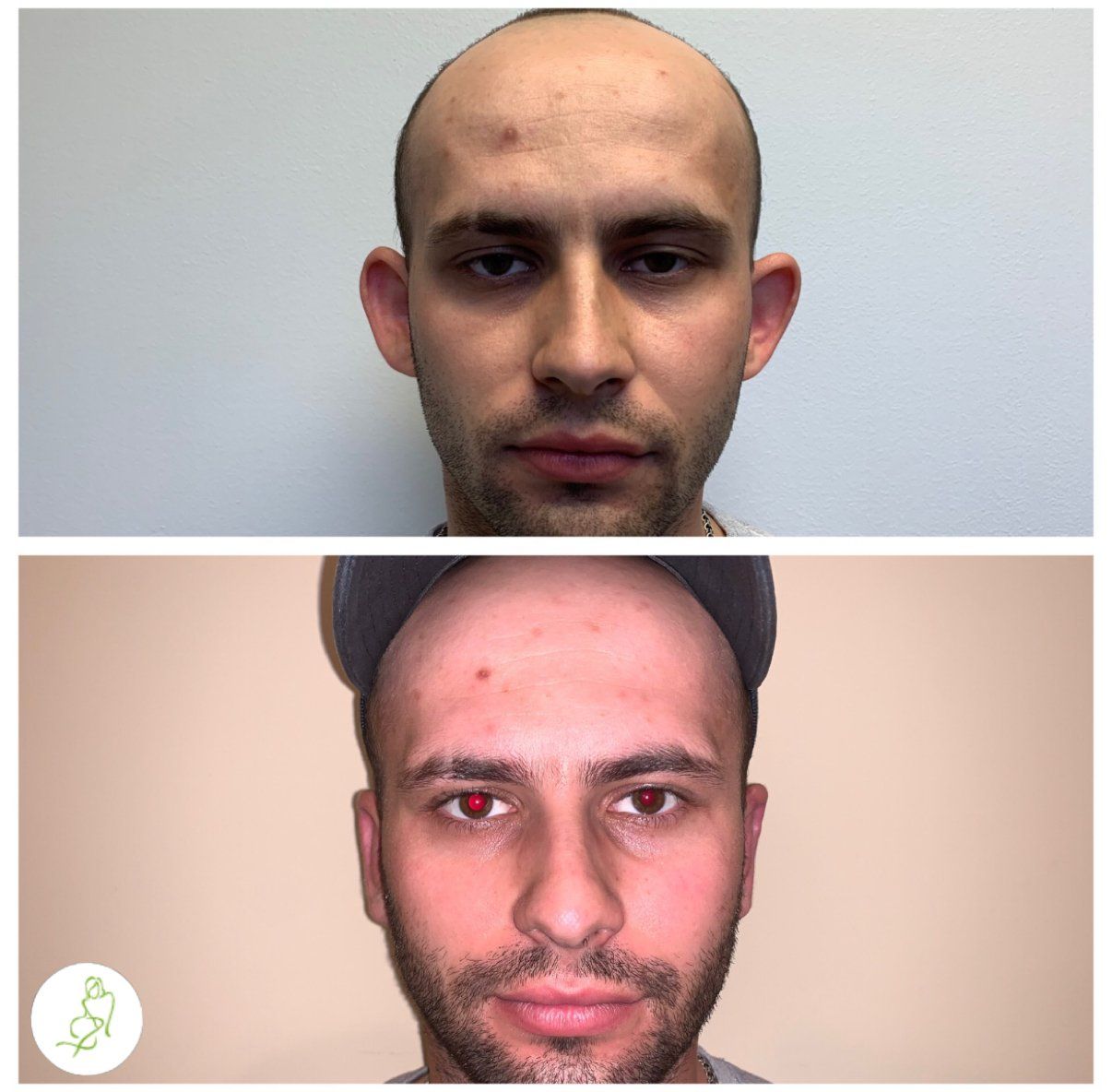 A before and after photo of a man 's head