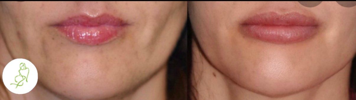 A before and after photo of a woman 's face