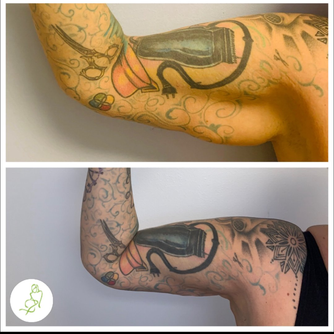 A before and after photo of a person 's arm with tattoos