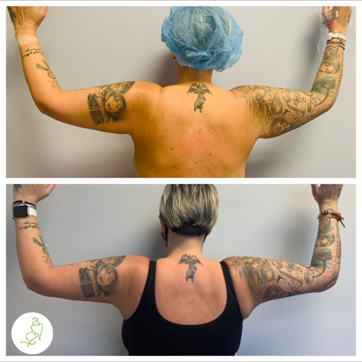 A before and after photo of a woman with tattoos on her arms