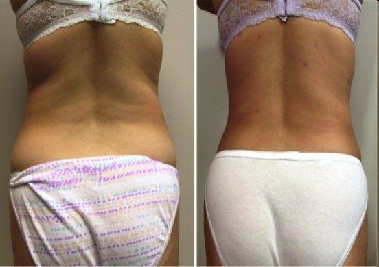 A woman in a bra and white underwear is standing in front of a wall.