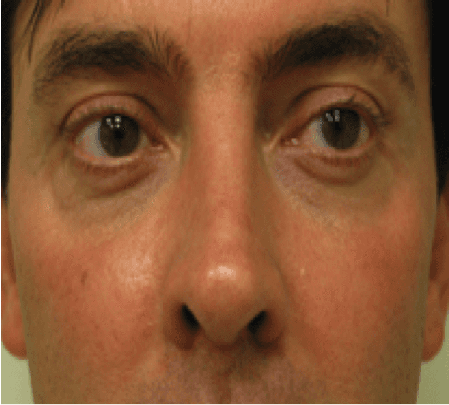 A close up of a man 's eyes and nose