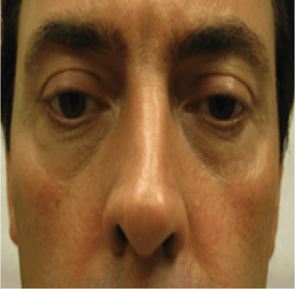 A close up of a man 's eyes and nose