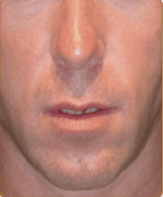 A close up of a man 's face with a nose and mouth