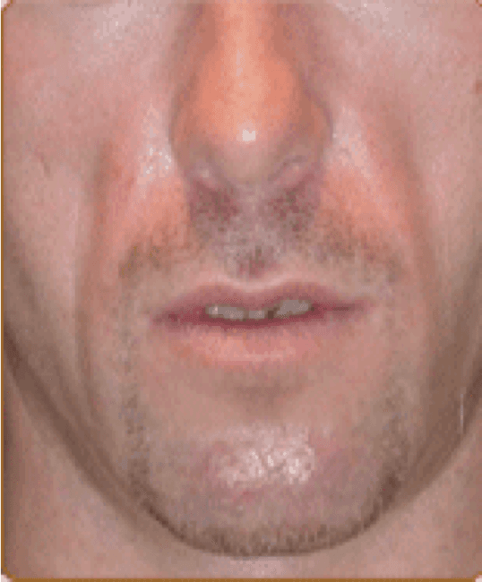 A close up of a man 's face with a beard