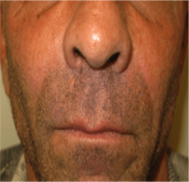 A close up of a man 's face with his eyes closed