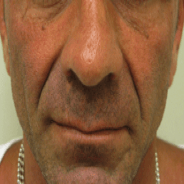A close up of a man 's face with his eyes closed