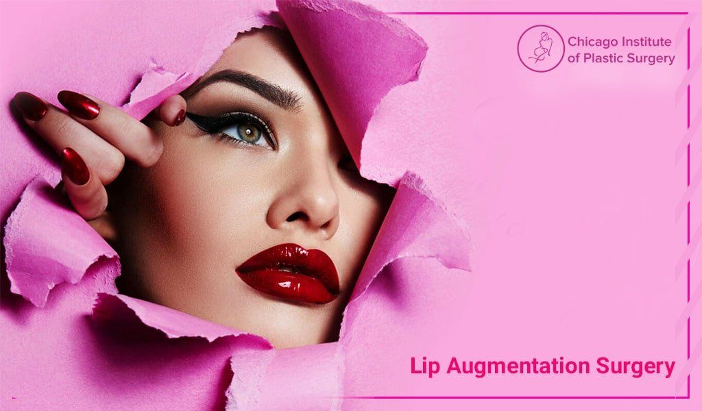 Lip Augmentation Surgery Clinic in Chicago
