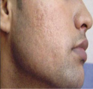 A close up of a man 's face with a beard