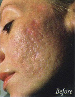 A close up of a woman 's face with the words before below it