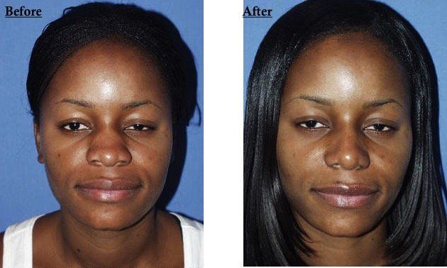 A before and after photo of a woman 's face
