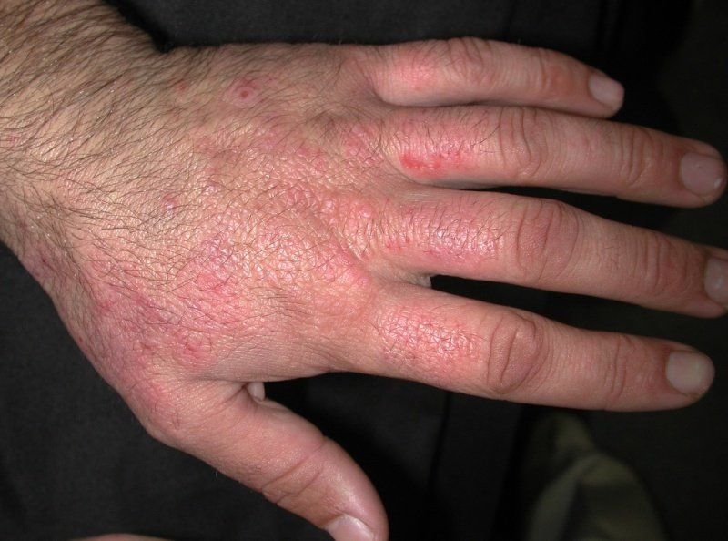 Chemicals on the Skin