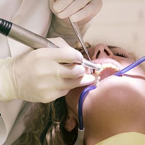 Dentist using tools to treat a patient’s teeth during a dental exam