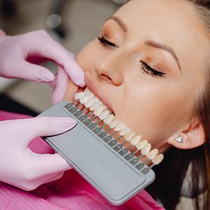 Dentist matching teeth shades with a patient using a color guide