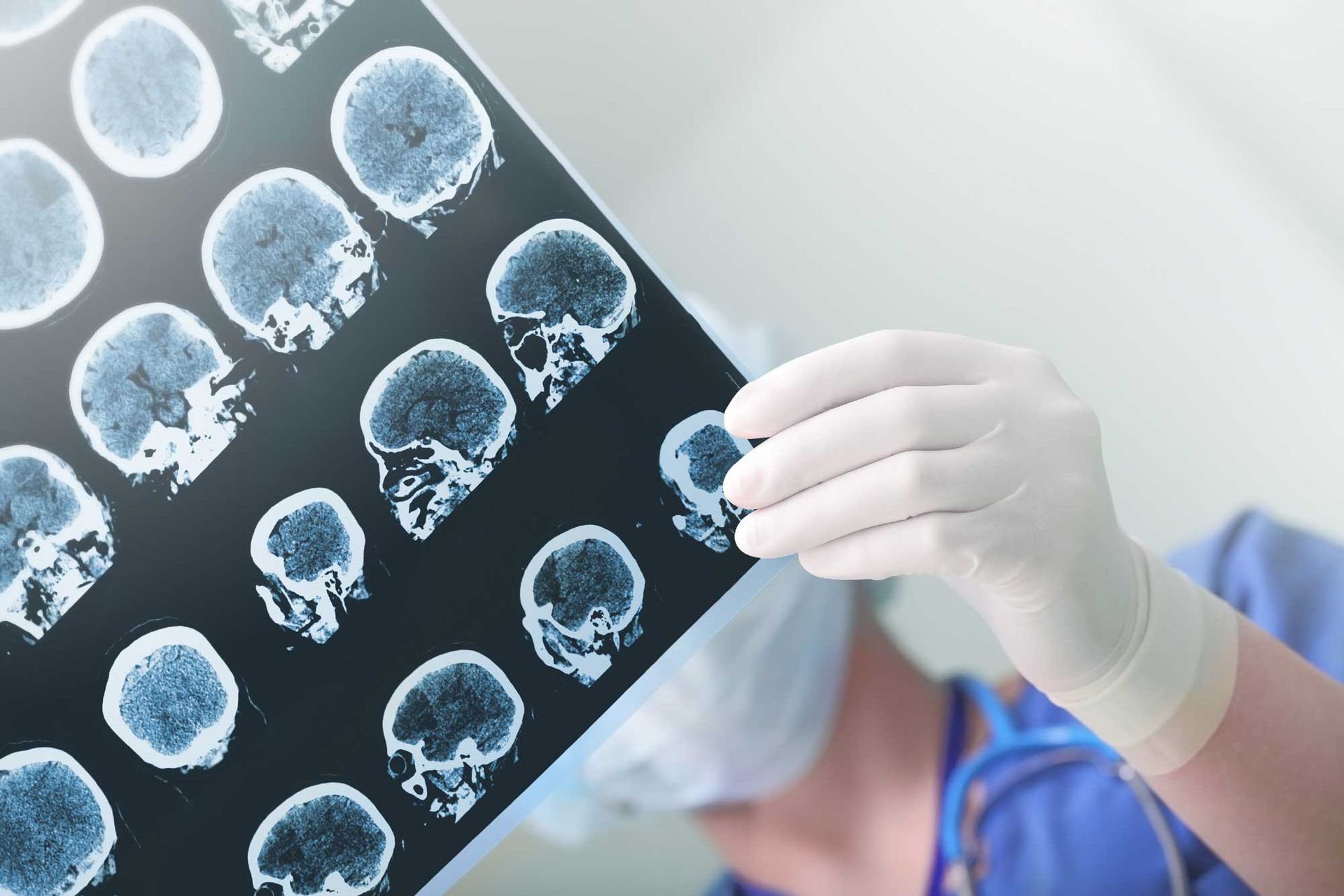 Gloved medical professional holding up a sheet of brain scan images for review.