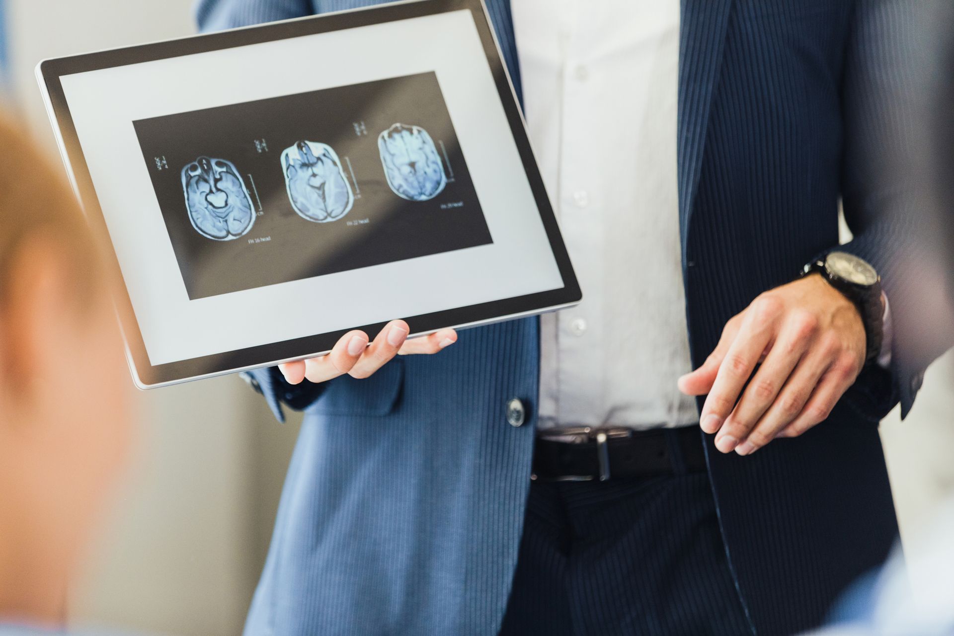 An attorney holds a digital tablet displaying a client’s brain MRI. An attorney holds a digital tablet displaying a client’s brain MRI.