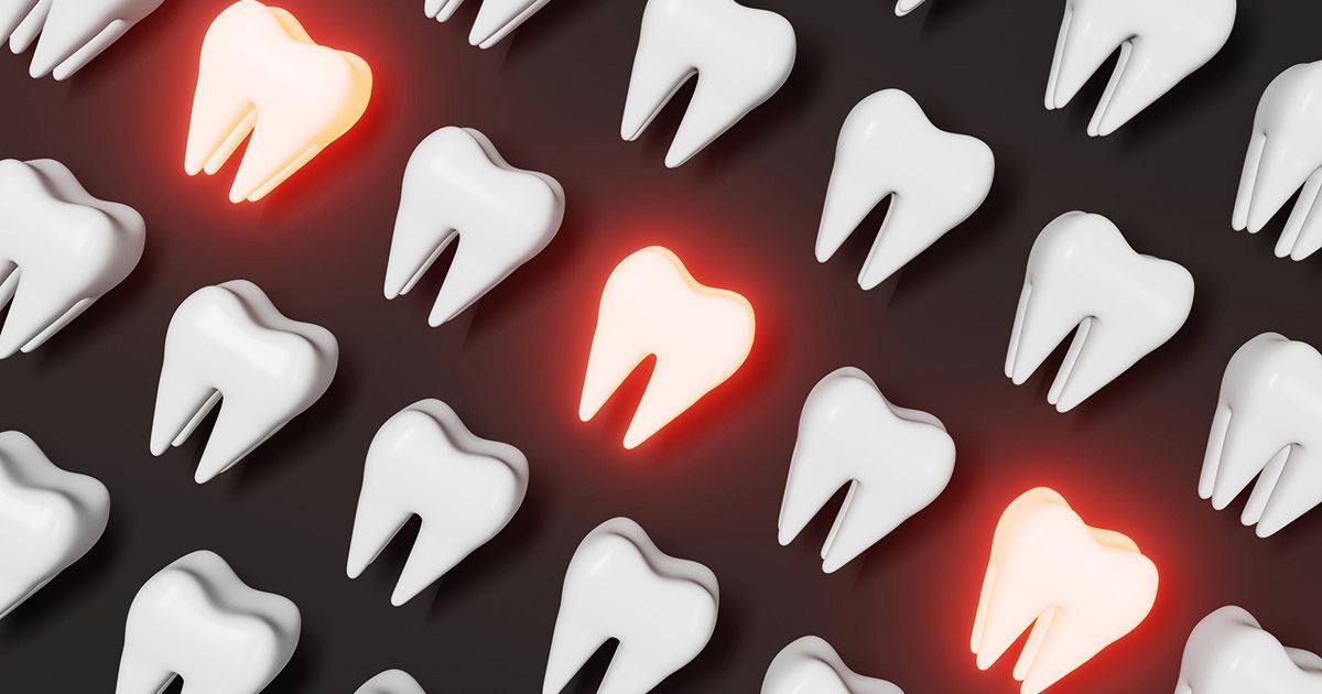 A group of white teeth are lined up in a row on a black background.