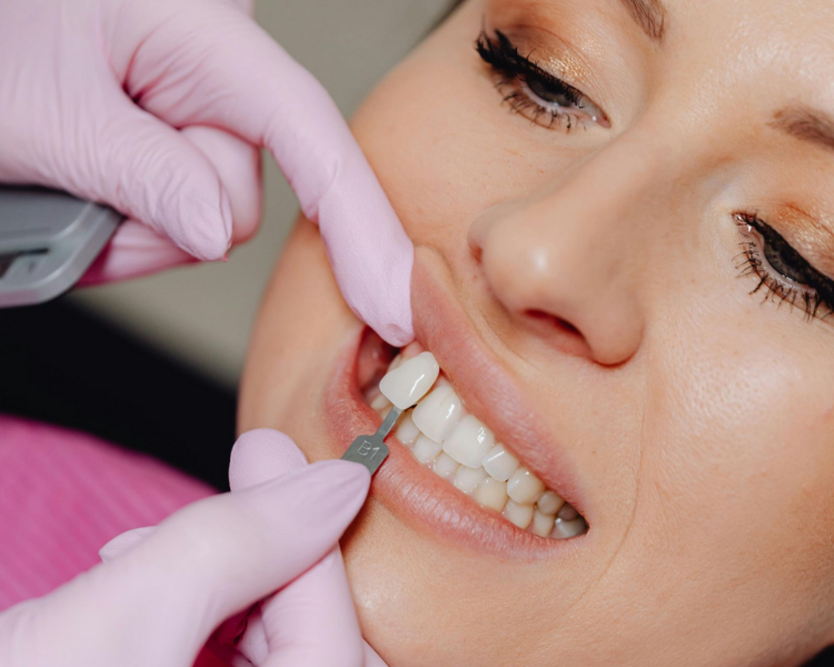 A close-up of a bright, white smile showing well-aligned, clean teeth and natural pink lips.