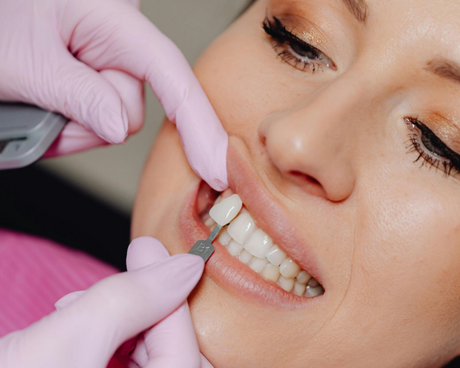 A close-up of a bright, white smile showing well-aligned, clean teeth and natural pink lips.