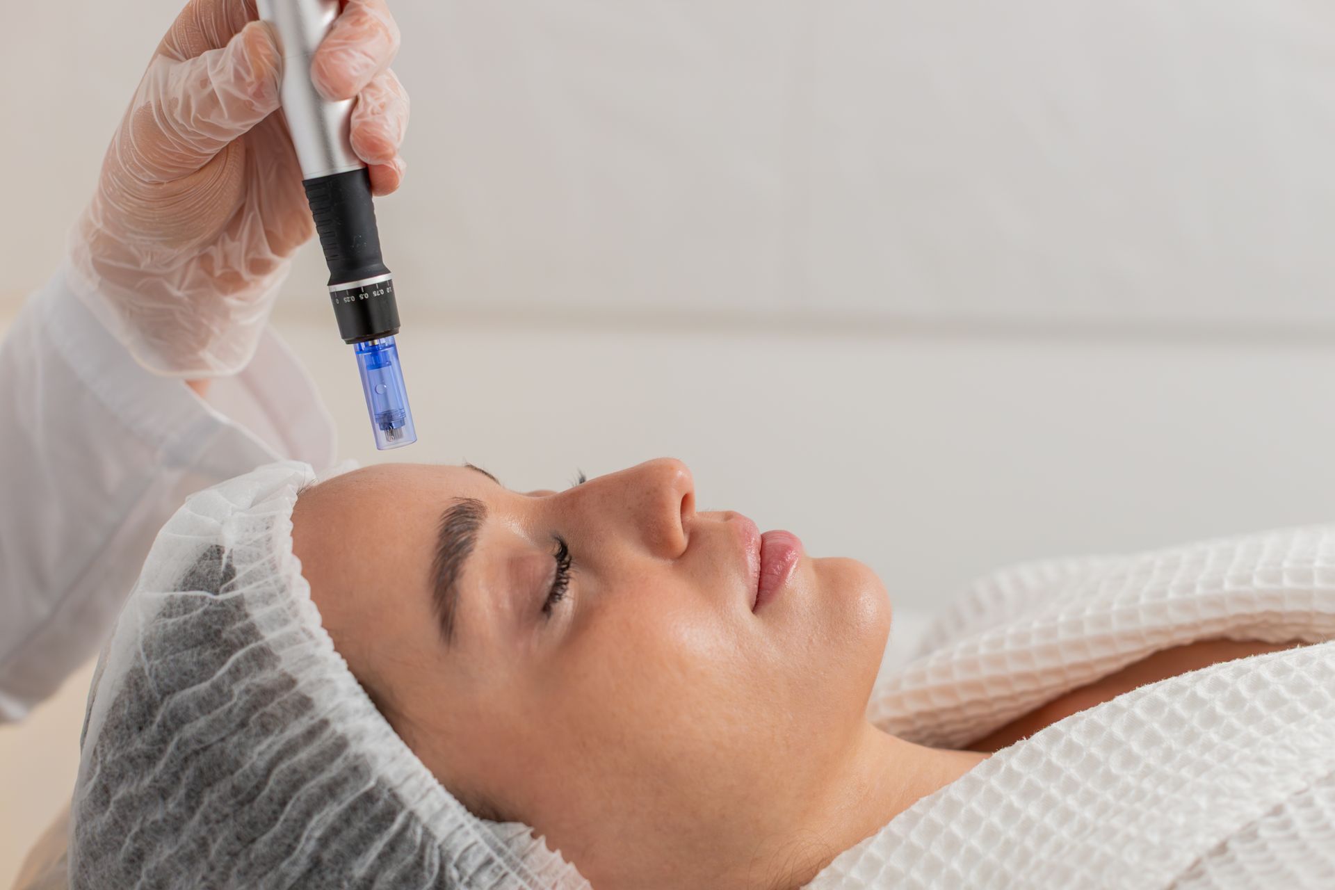 Woman receiving microneedling treatment with closed eyes, in spa setting.
