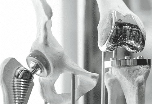 medical 3d printing image