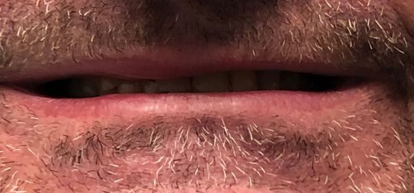 Close-up of a person's mouth and beard. Their lips are closed, revealing teeth, with a slightly stubbled beard.