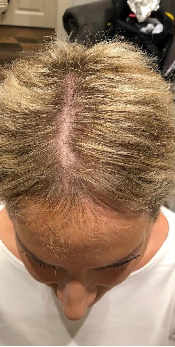 hair intergration system  treatment by la bella vita in  belfast