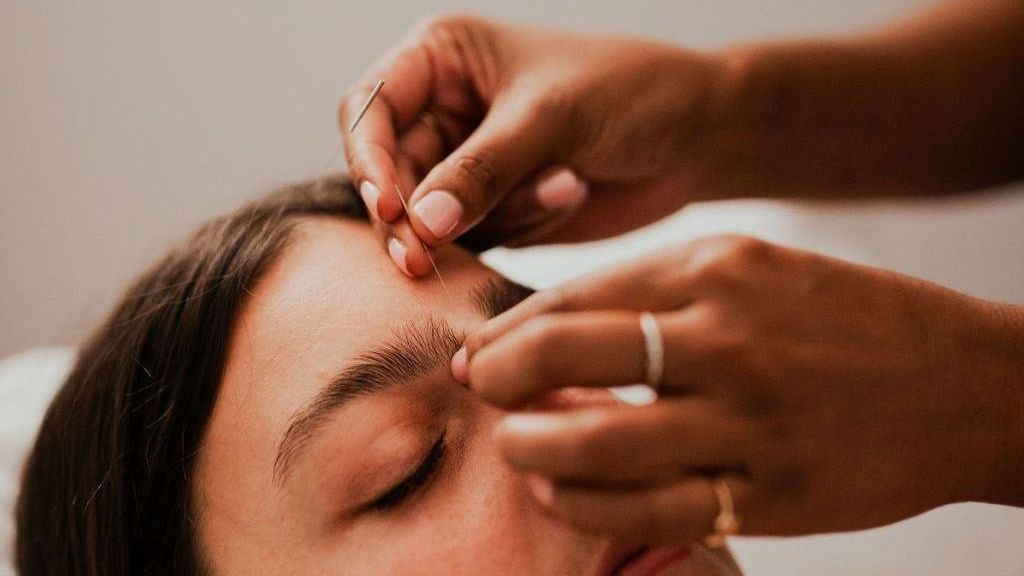 A woman is getting an acupuncture treatment on her forehead.